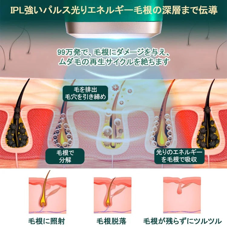 IPLレーザー脱毛器